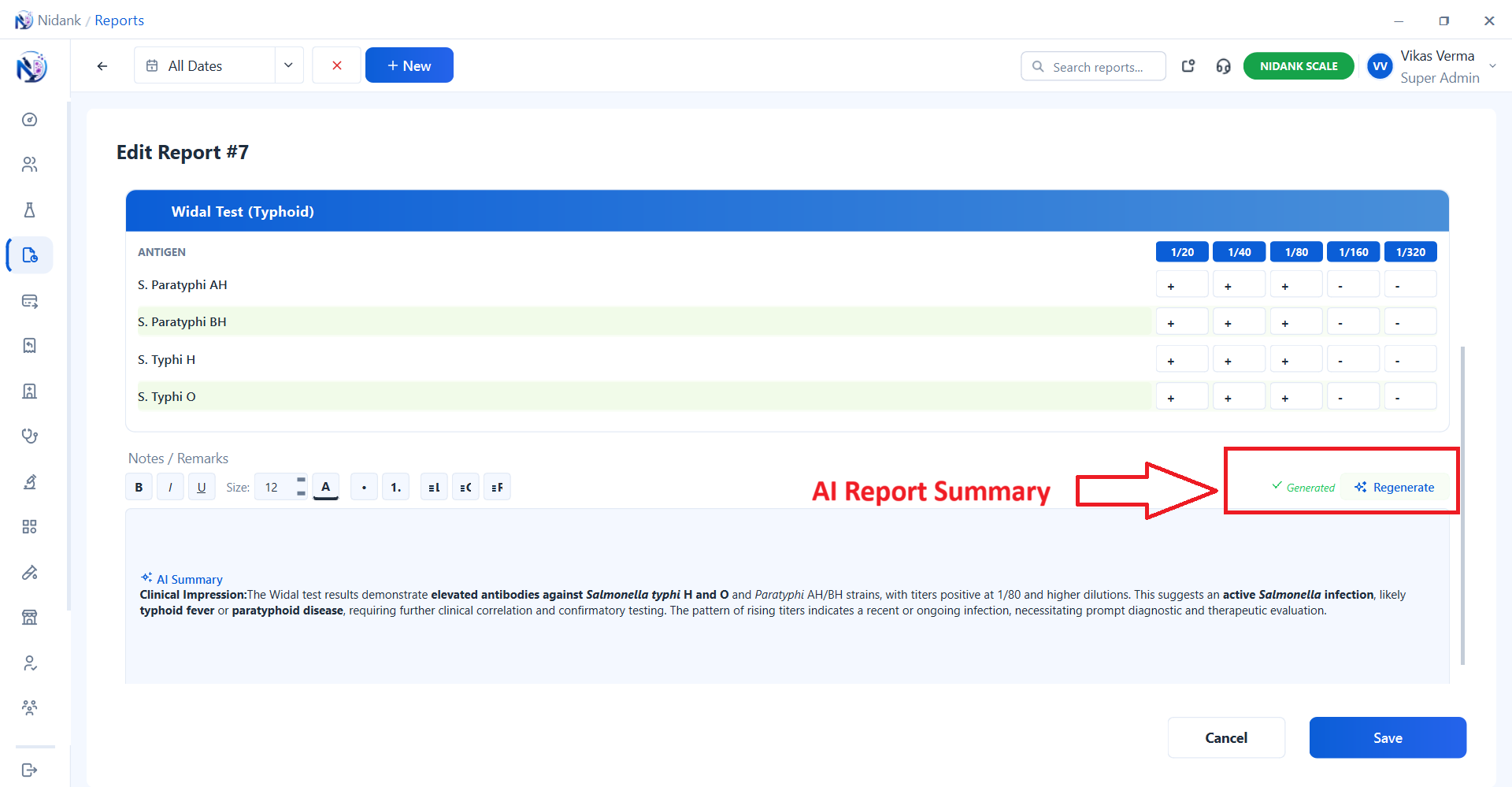 Software Preview 3